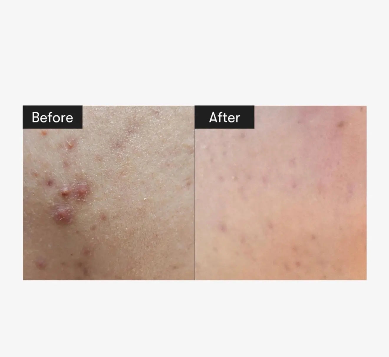 Reedle Shot 100 sejas serums ar mikroadatām – VT Cosmetics