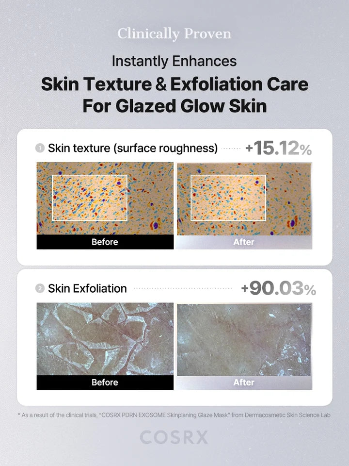 Corsx Acne Pimple Master Патчи от акне