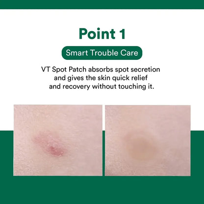VT COSMETICS Cica Care Spot Patch