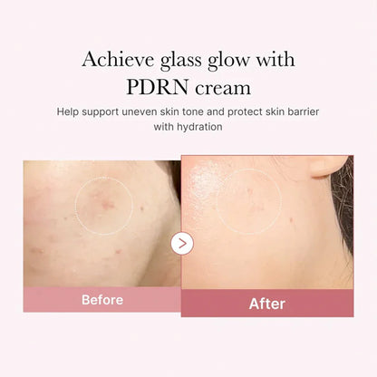 Medicube PDRN Pink Hyaluronic Moisturizing Cream