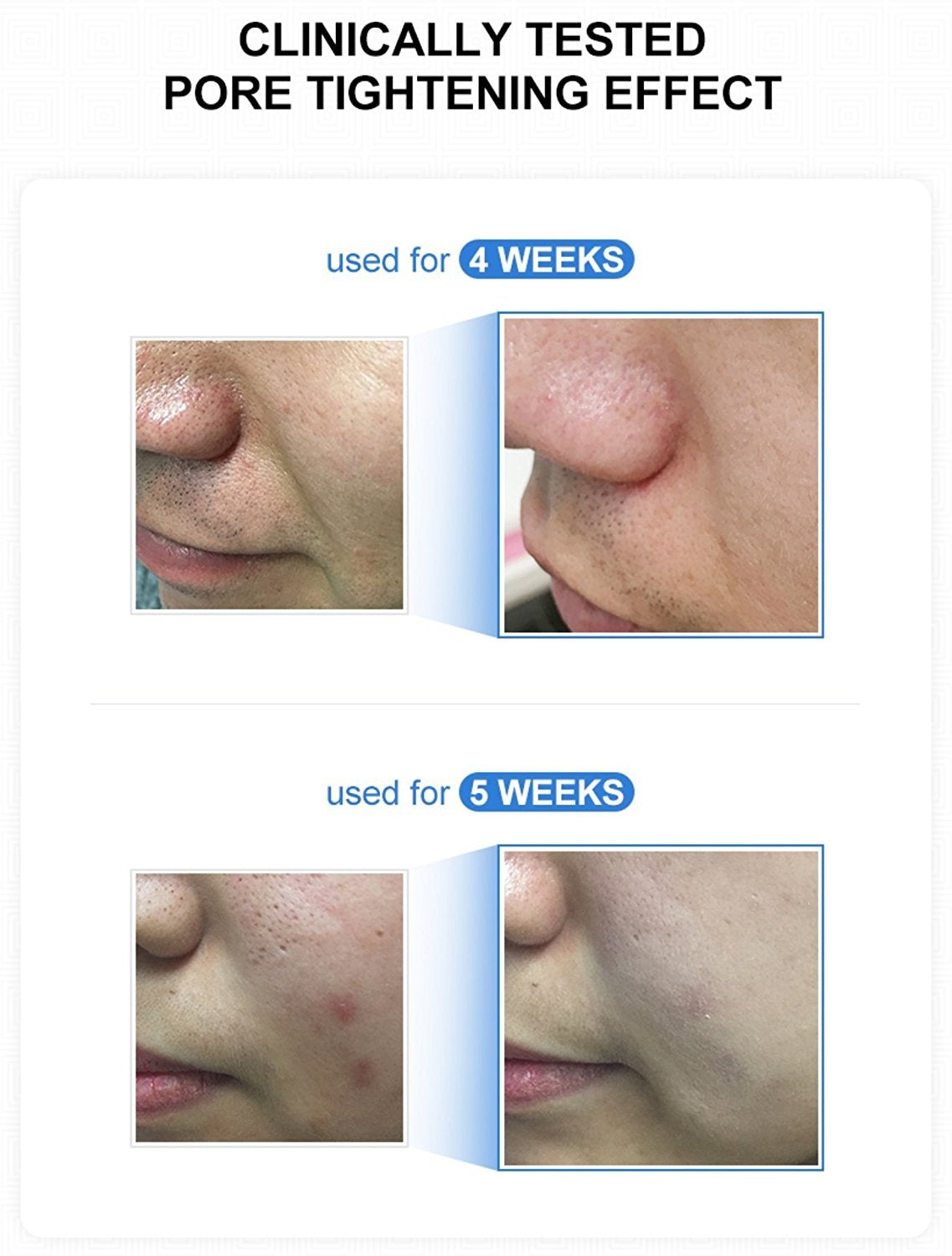 Medicube Zero Pore Pad 2.0 attīrošie sejas spilventiņi